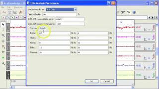 EEG  Automated Filtering [upl. by Orravan]