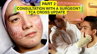 SEVERE ACNE SCARS AND FOLLOW UP CONSULTATION  My TCA CROSS Experience Philippines  Envi Part 2 [upl. by Kirst907]