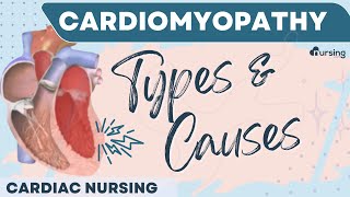 Cardiomyopathy Types and Causes Cardiac Nursing [upl. by Negem]