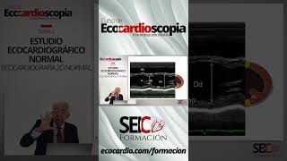 Curso de Ecocardioscopia Ecocardiografía básica [upl. by Romain]