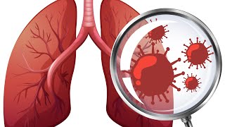 PneumoniaIntroductionclassification and causes 🫁dbmciofficial damsdelhi PrepLaddermedpg [upl. by Norma]