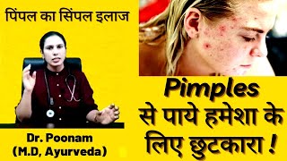 Pimples Kaise Hataye  Pimples Ke Daag Kaise Hataye  Pimples Removal On Face At Home Hindi [upl. by Poll]