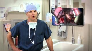 Transoral Surgery for Head and Neck Cancer  Mayo Clinic [upl. by Anwahsal]