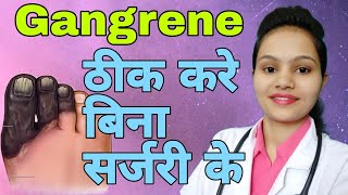 Top Best Homoeopathic medicine for Gangrene in hindi [upl. by Mallina]