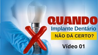 QUANDO O IMPLANTE NÃO DA CERTO AS CAUSAS  VIDEO 1 [upl. by Banquer]