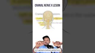 Cranial Nerve X Lesions for the USMLE  HyGuru [upl. by Lilhak]