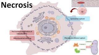 Necrosis  cellular mechanism and types [upl. by Yecaj730]