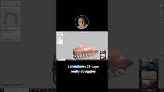 3Shape Denture Design Advanced Tips amp Tricks with Jimmy Stegall CDT shorts [upl. by Zorana]