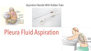 Aspiration Needle With Rubber Tube  Pleural Fluid Aspiration  Sites of Aspiration  Indications [upl. by Dawna]