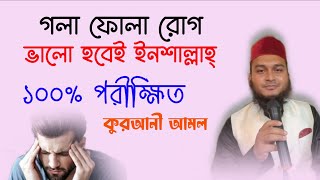 গলা ফোলা রোগ দূর করার উপায় আমল দোয়া অজিফা  gola fola rog dur korar upay amol doah ojifa todbir [upl. by Shep]