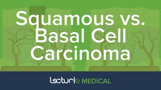 Squamous Cell Carcinoma SCC vs Basal Cell Carcinoma BCC  Dermatology [upl. by Elah842]