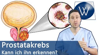 Prostatakrebs Gibt es Risikofaktoren und welche Symptome können auftreten Vorsorge amp Therapie [upl. by Watanabe545]