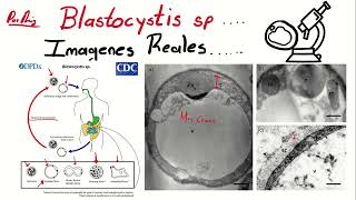 Blastocystis hominis al microscopio óptico [upl. by Calandria]