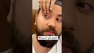 عيني راحت لأجل العراق💔🇮🇶 فهدالشلهومي اكسبلور shorts short العراق [upl. by Ardnosac98]