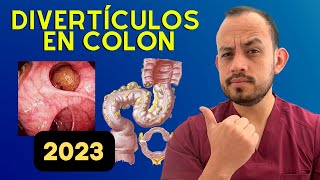 DIVERTICULITIS  DEFINICIÓN MÉDICA  Interpretacion Consecutiva [upl. by Eiramyllek753]