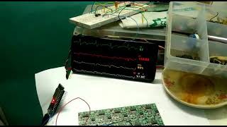 How to make your own Patient Multipara monitor  DIY ECG SPO2 BP MONITOR  For help subscribe [upl. by Ear433]