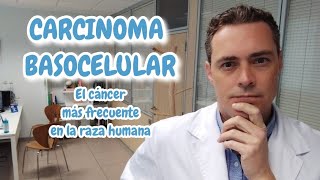 Carcinoma basocelular El tumor maligno más frecuente en el ser humano [upl. by Maurey]