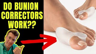 DO BUNION CORRECTORS WORK Doctor explains [upl. by Rehportsirhc]