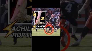 Doctor explains Deshaun Watson Achilles injury in 60 seconds browns nflnews anatomy medical [upl. by Lilith441]