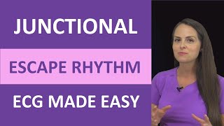 Junctional Escape Rhythm ECG Made Easy Nursing Next Generation NCLEX EKG [upl. by Hsakiv]