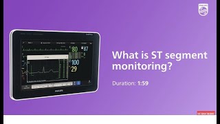 What is ST segments monitoring [upl. by Charteris]