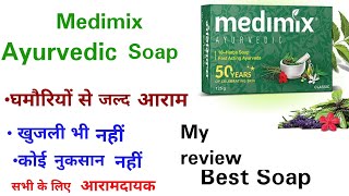 Medimix Ayurvedic Soap  My review on medimix ayurvedic soap  मेडिमिक्स साबुन घमौरियों में आराम [upl. by Ellehcyt]