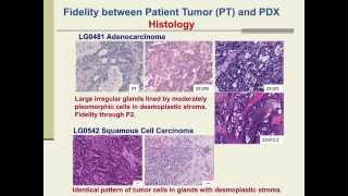 PatientDerived Xenografts for Cancer Therapeutics Development and Predictive Modeling [upl. by Niwle]