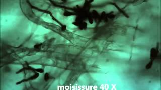 moisissures au microscope [upl. by Barbaresi392]