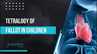 What is Tetralogy of Fallot in Children Dr Vipin Sisodiya [upl. by Anitan]