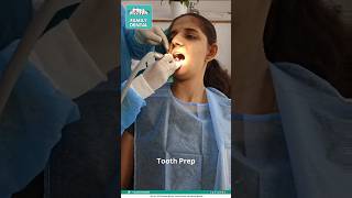 Tooth Preparation for capping [upl. by Miett]