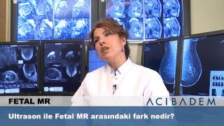 Ultrason ile Fetal MR arasındaki fark nedir [upl. by Firman]