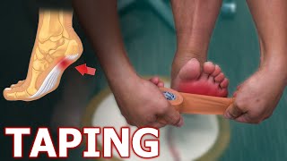 Relieve Pain From Plantar Fasciitis With This EASY Taping Method [upl. by Tnirb64]