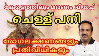 ചെള്ള് പനി കേരളത്തിലും  Scrub Typhus Symptoms and precuations [upl. by Luing]