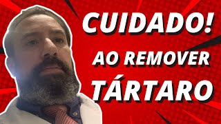 Como tirar tartaro dos dentes em 3 minutos Cuidado [upl. by Nuhsar662]