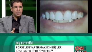 Porselen yaptırmak için dişleri kestirmek gerekir mi [upl. by Machutte680]