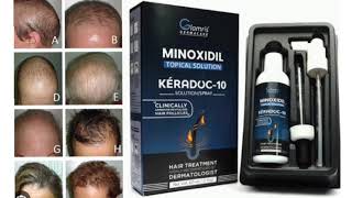 MINOXIDIL TOPICAL SOLUTION KERADOC 10 SOLUTION SPRAY [upl. by Analim]