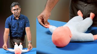 Moro Reflex and Asymmetric Tonic Neck Reflex  Edition 8 Sample Video Paediatrics [upl. by Enerol76]