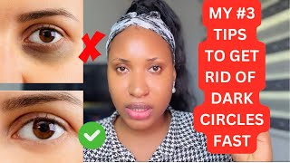 How To Get Rid Of Dark Circles Eyes Dark Circles Fast Remedies [upl. by Harris]