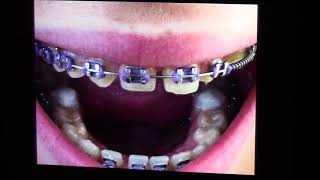 Russian Orthodontics [upl. by Enej]