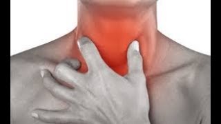 Biodescodificación  Mononucleosis [upl. by Nraa]