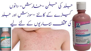 Calamine lotion Uses and side effects in Urdu Hindi calamine lotion benefits Allergies Itching [upl. by Rubenstein]