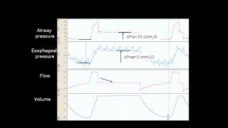 Partitioned compliance of the respiratory system and transpulmonary pressure [upl. by Simmons]