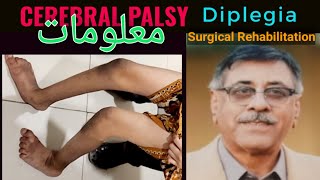 Spastic Cerbral Palsy Diplegia Detailed overview  Surgical and Rehabilitation Treatment Pathways [upl. by Abel640]