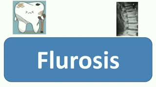 Flurosis  Affect Teeth Skeletal amp other system of body Causes Symptoms Diagnosis Treatment [upl. by Mitchell341]