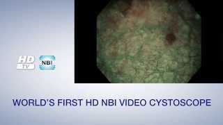 Olympus NBI Urology Video  English Version [upl. by Zoilla]