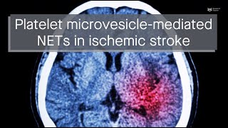 Platelet microvesiclemediated NET formation promotes thrombosis brain injury in ischemic stroke [upl. by Santa531]