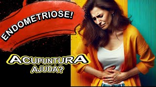 Como a Acupuntura Pode Reduzir os Sintomas da Endometriose [upl. by Swann]