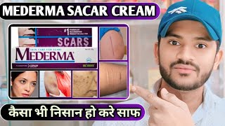 Medrma scar cream use dose benefits and side effects full review hindi [upl. by Kir]