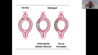 Anti Arrhythmic Drugs Part 2 [upl. by Chloe]