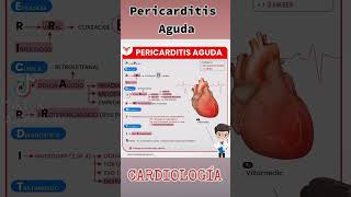 Pericarditis Aguda Cardiología Medicina Resúmenes Tips [upl. by Anetsirhc]